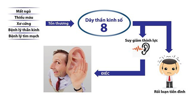 9 nguyên nhân gây ù tai chắc chắn bạn chưa biết - 2